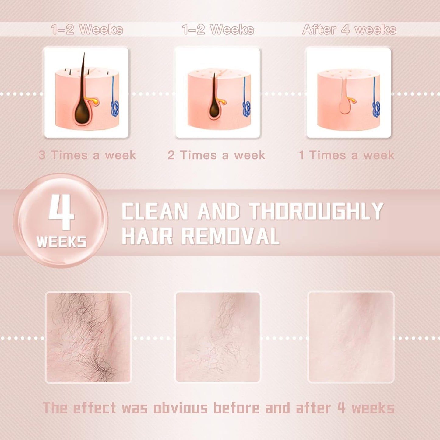 IPL Laser Hair Removal Device for Women and Men